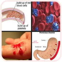 All Blood Disease & Treatment